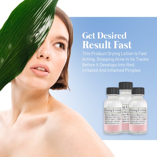 Acne Drying Lotion Organic Skin Care