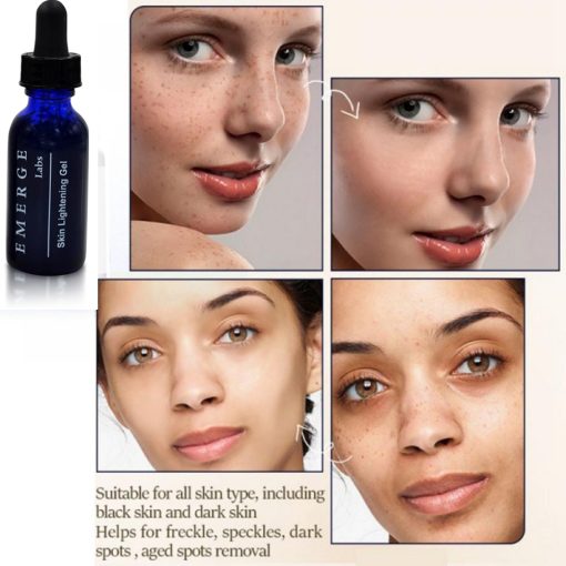 Skin Lightening Serum - Dark Spot Corrector with Kojic Acid For Face & Body - 1oz 1