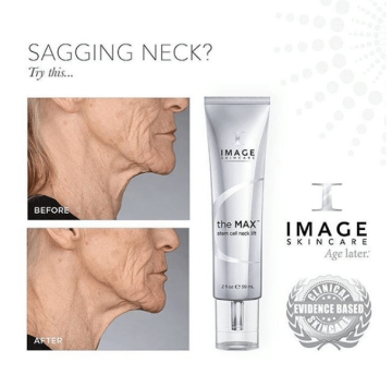 Image Skin Care The MAX Stem Cell Neck Lift - 2oz 2
