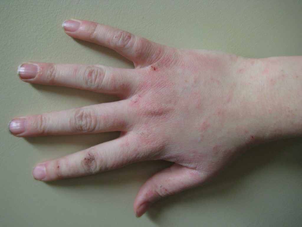 natural moisturizer, best hyaluronic acid, benefits of hyaluronic acid