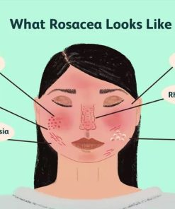 Organic Skin Care Products For Rosacea Skin