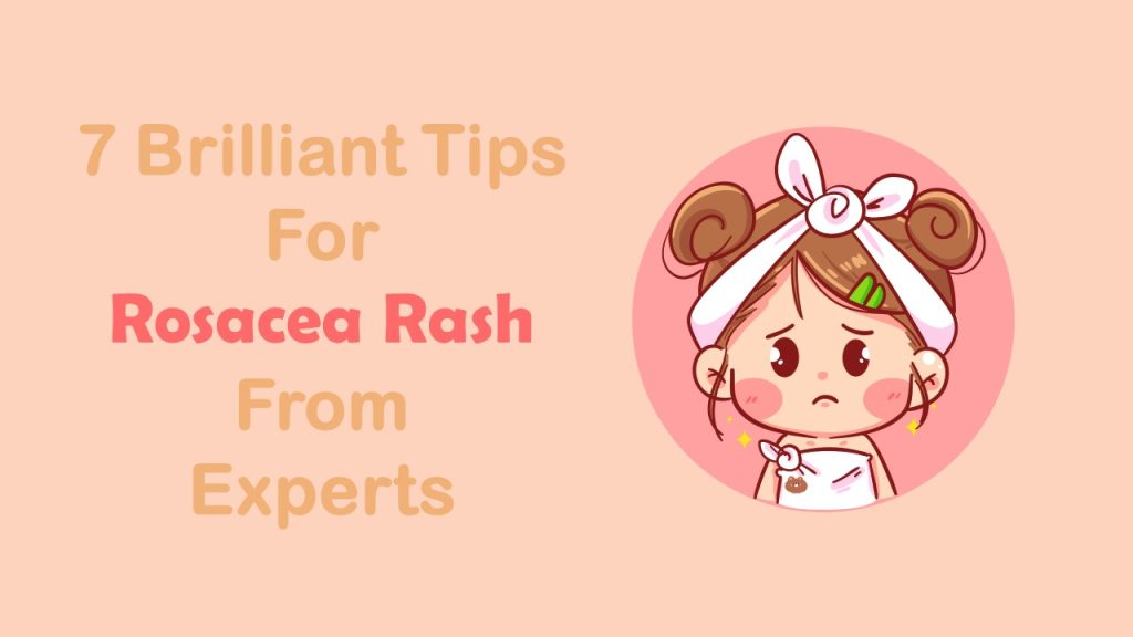 skin condition rosacea rash