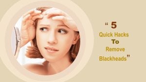 blackheads removal; quick ways to help with blackheads removal