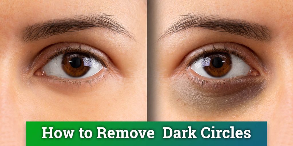 How to Get Rid of Under Eyes Dark Circles: Natural Remedies & Organic Skin Care Products