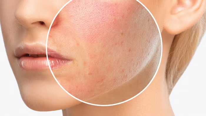 Allergic Reactions Main Cause In Skin Care Products • Best Of Organic Skin Care Products In 2024