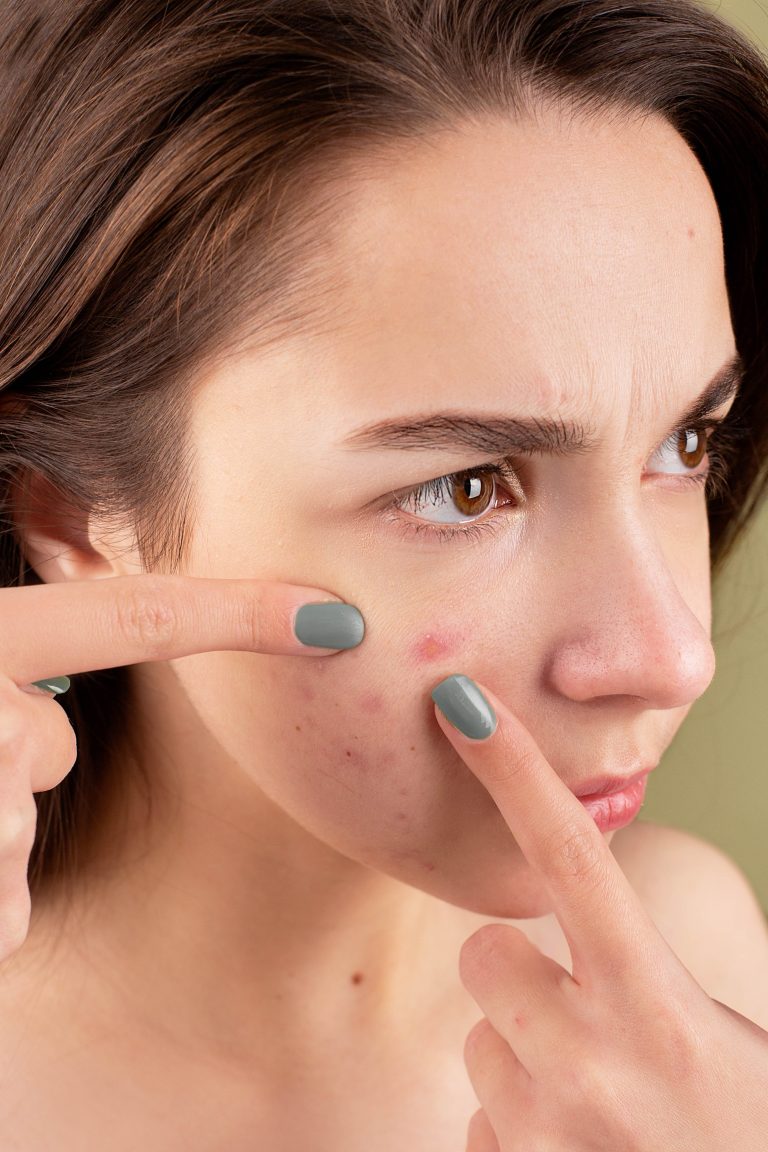 Organic Facial Oils For Acne And Clogged Pores 2