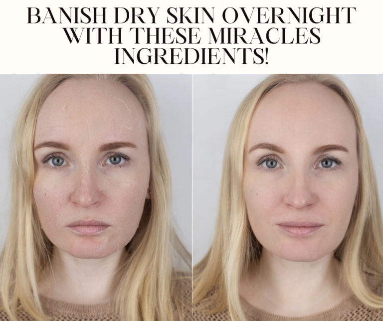 Banish Dry Skin Overnight with These Miracles Ingredients!